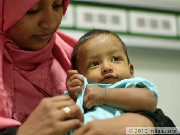 Help Baby Adam Ali Fight Biliary Atresia