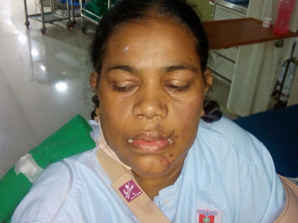 Help My Mother Who Met With A Train Accident