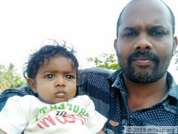 This 4 month old baby needs a liver transplant to survive