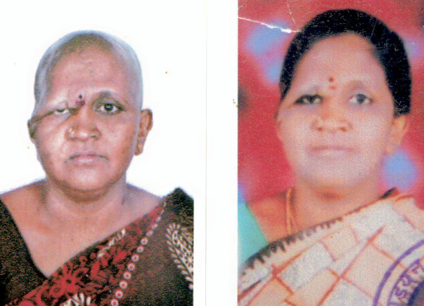 Rathna needs to undergo chemo to live for her 2 disabled daughters: