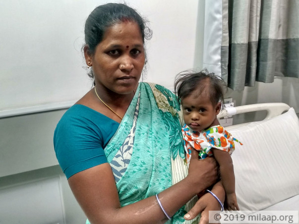 9-month-old With Down Syndrome Needs Urgent Heart Surgery