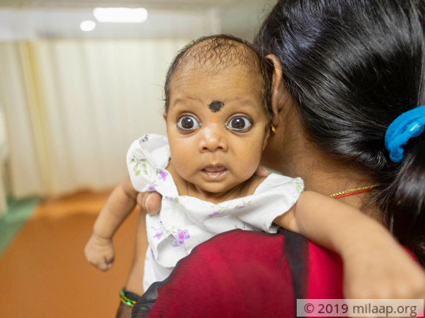 Help Baby of Namasvi Undergo AV Canal Defect Repair Surgery