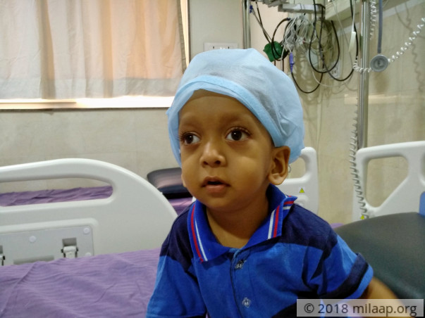 This baby boy will lose his vision without a bone marrow transplant
