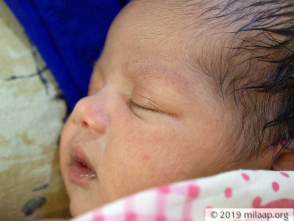 Baby of Pragya needs your help to survive