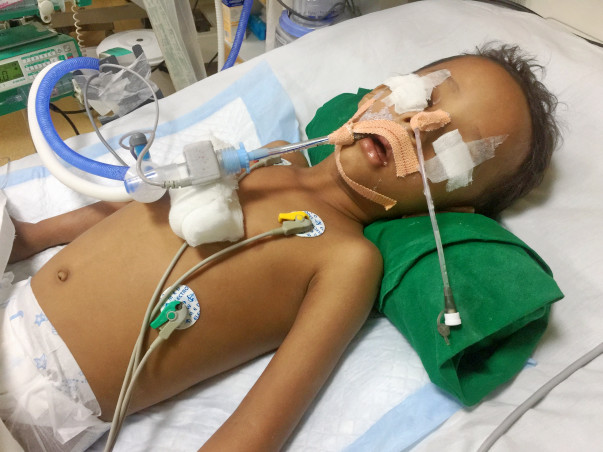 Help 3 Year Old Asad Open His Eyes