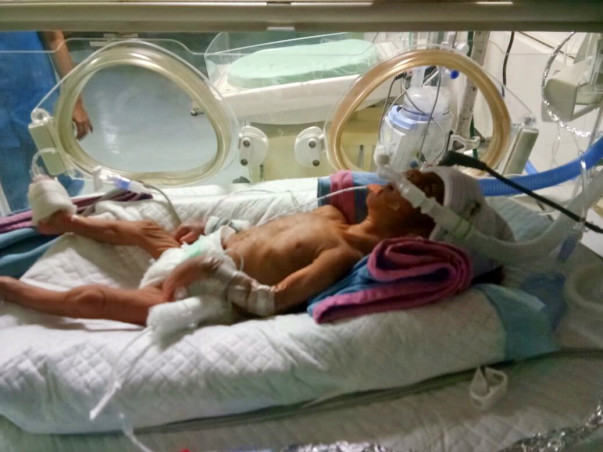 Help Kumara Swamy To Save His Premature Born Baby Boy