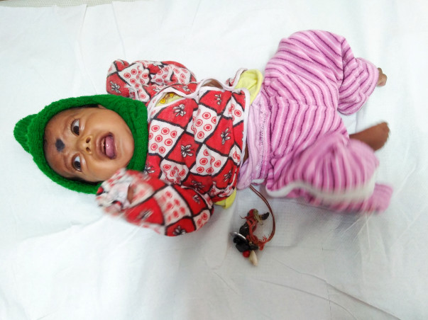Help Baby Rinku Undergo A Heart Surgery
