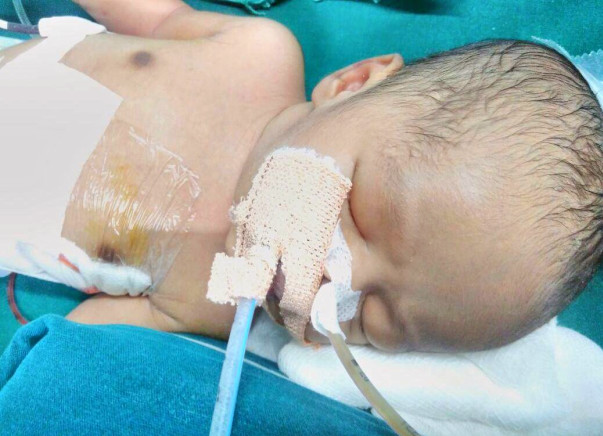 Baby Of Nazia Needs Your Help To Live