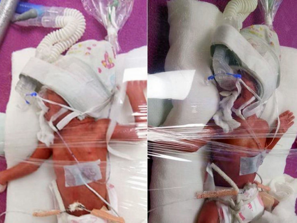 Help My New Born Twins Fight Battle Of Life