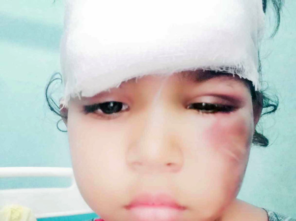 Help Vishnupriya recover from accident