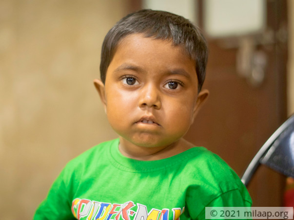 This 5-Year-Old’s Legs And Joints Are Swollen That She Can't Walk