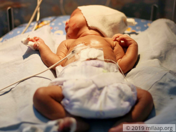 Help Baby of Rupabai Recover From Severe Dyselectrolytemia