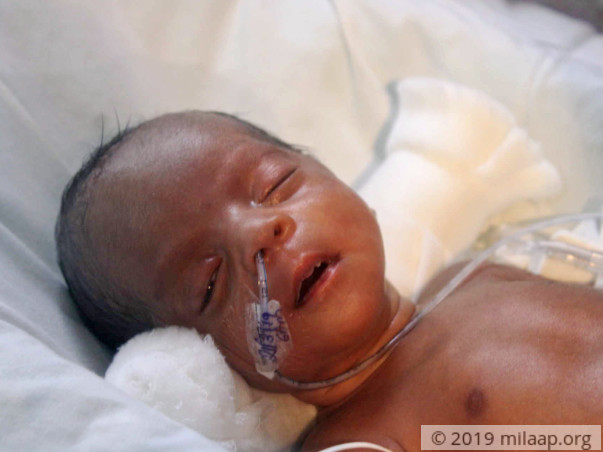 Twin Babies of Jeyakumari Premature needs your help to survive