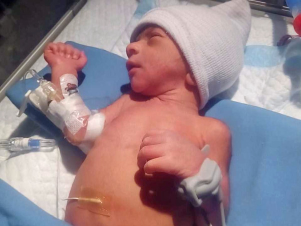 Help My Premature Baby Son To Recover From ICU