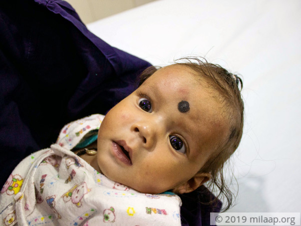 Daily Wager's 8-Month-Old Is Battling A Dreadful Heart Disease