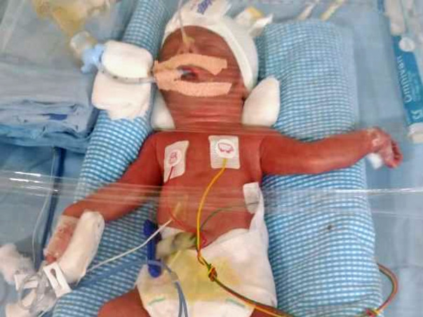 Support My Baby Recovery, Born Prematurely.