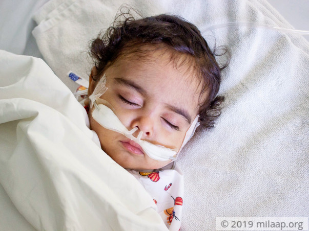 8-month-old Mudit needs a liver transplant to survive