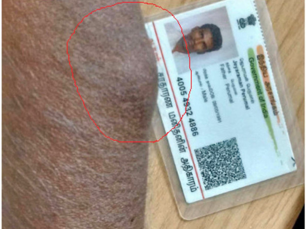Help Jeyaraman Peruman For His Cancer Treatment