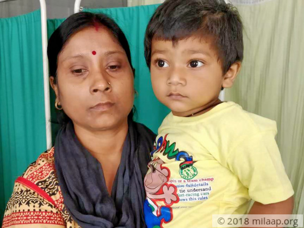 Baby Avirup needs a heart surgery his parents cannot afford