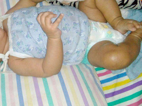 Help Save The Life Of My 8-month-old Daughter