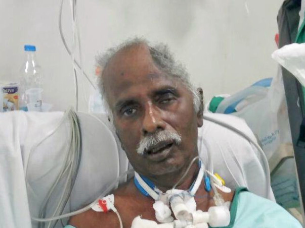Help My Uncle To Live