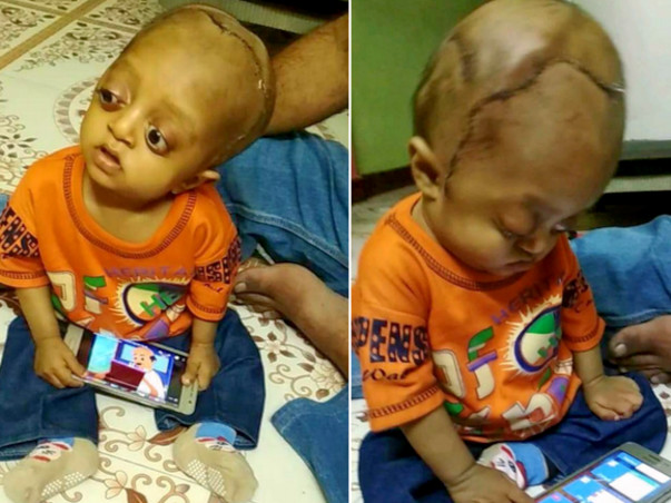 Help Ibrahim Lead A Normal Life