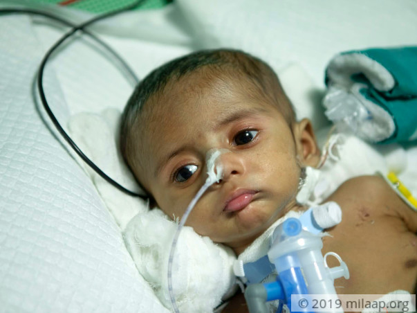 Help Baby of Haritha Rani Undergo VSD Closure