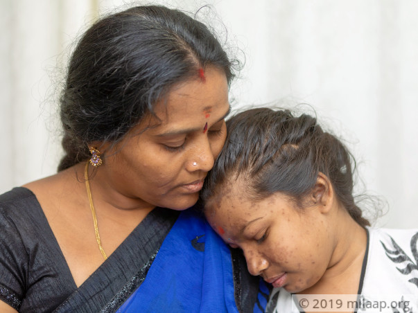 Help 12 year kid to fight SLE disease