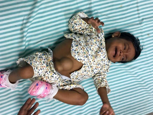Help This 1-year-old Srilankan Baby Who Has End-stage Liver Disease