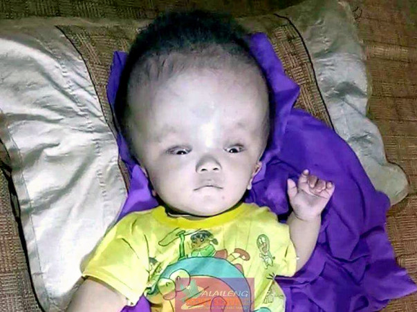 Mimin's Head Will Explode If You Don't Help Him