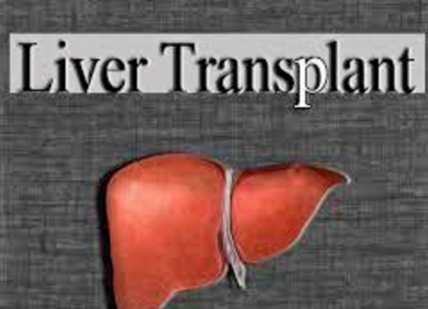 I am fundraising to husband's Liver Transplant