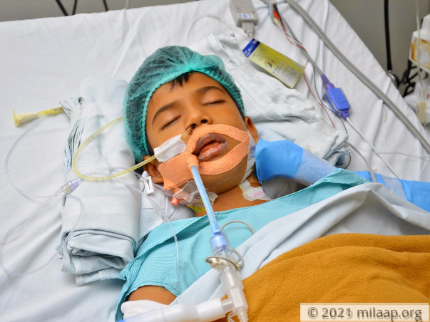 Help Manish Fight Liver Problem