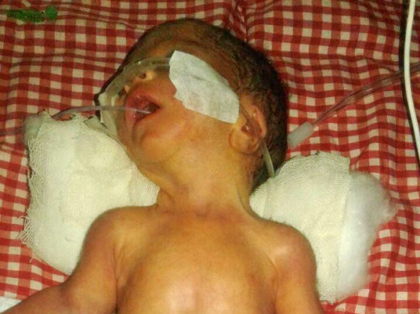 Help Ashok premature baby survive