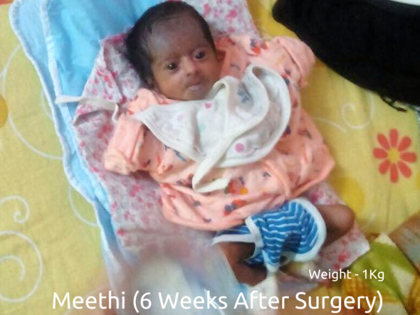 Help 2-Months Old Meethi Fight Intestinal Malrotation
