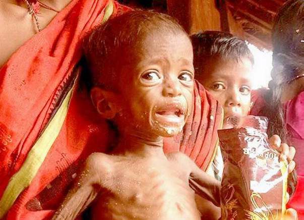 Feed a Tribal Child from Hunger | April 2017