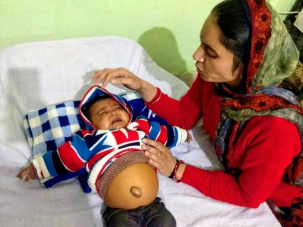 Help This 6-Month-Old Baby Girl Whose Stomach Is Bloating Every Second