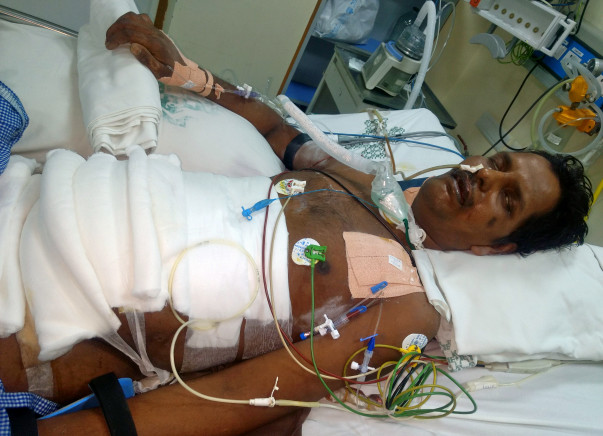 Help Balamurugan To Fight Severe Acute Pancreatitis