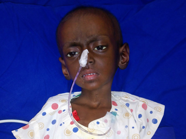Help Dhruvankur for bone marrow transfer treatment