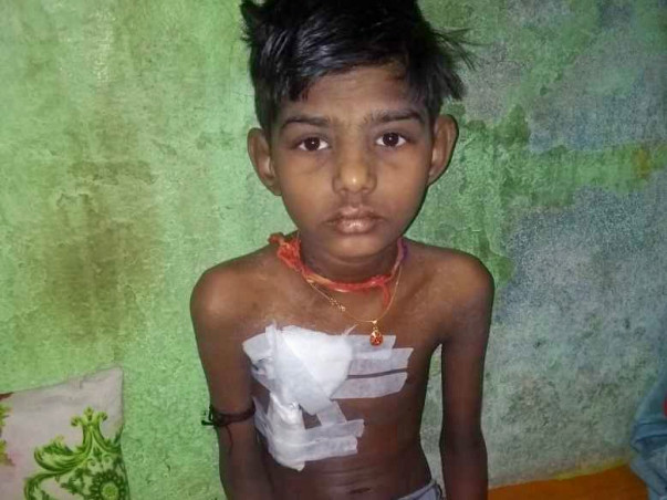 Help Gaurav undergo Kidney Transplant