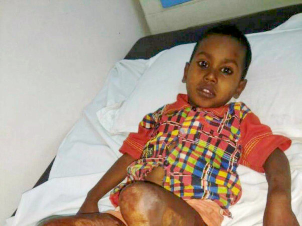 HELP BABY KARAN RECOVER FROM HIS PAIN!