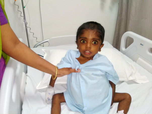 Help 2-year-old Sriesha fight end stage liver failure