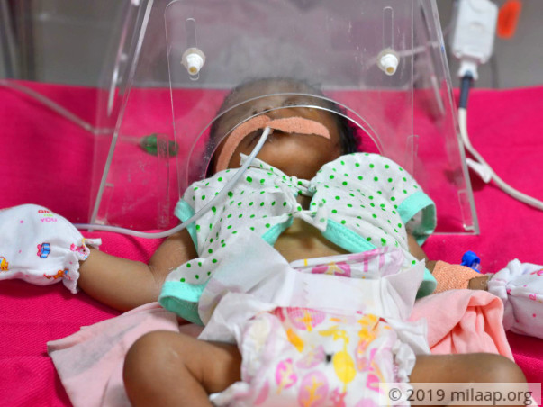 Help Baby Of Gangeswari Undergo Open Heart Surgery