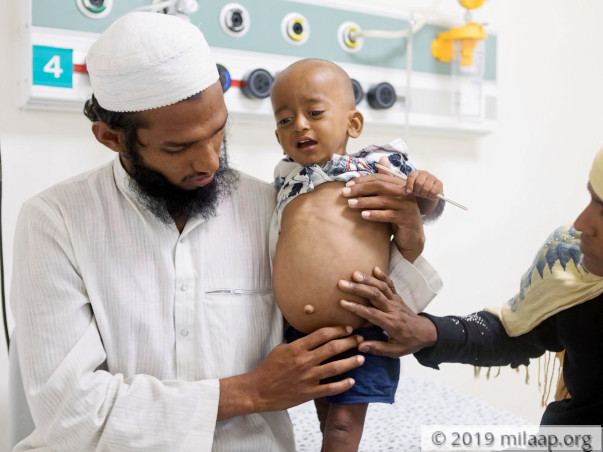 Help Baby Muzzamil Fight Chronic Liver Disease