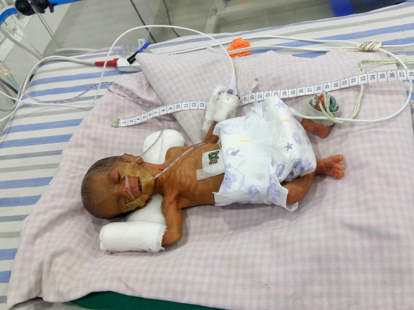 Father of a Premature Baby Sold All He Had To Try And Save His Baby