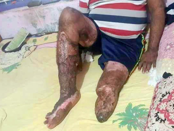 Help the Only Breadwinner of the Family Get Back On His Feet Again