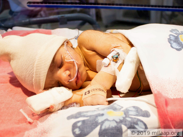Only An Urgent Surgery Can Save This 11-Day-Old Baby Boy's Life