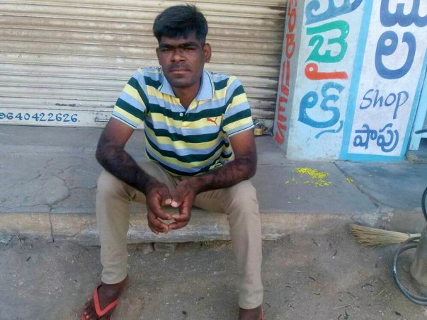 Help Murali fight Acromegaly
