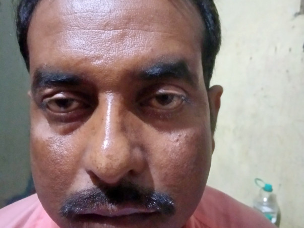 Help Me For Renal transplant