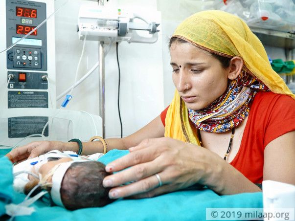 Baby of Pooja needs your help to survive