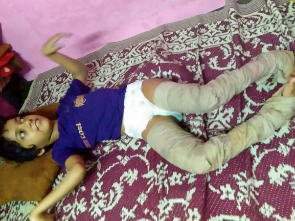 Help Ashifa To Overcome Her Physical Challenges